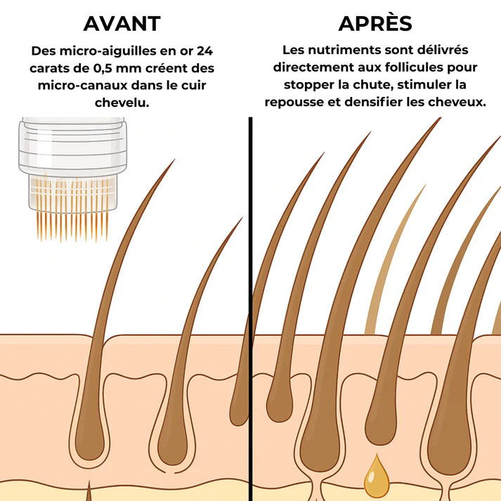 TRAITEMENT CAPILLAIRE - MICROROOT®