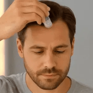 TRAITEMENT CAPILLAIRE - MICROROOT®